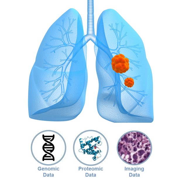 Lung Cancer 