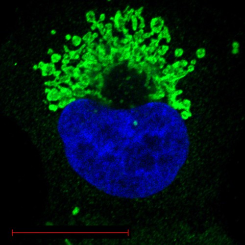 Ras Protein IHC